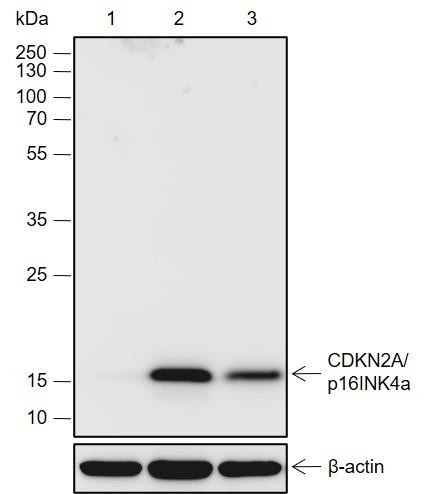 Recombinant CDKN2A/p16INK4a Monoclonal Antibody (AGEL6917)