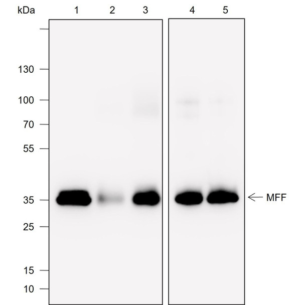 Recombinant MFF Monoclonal Antibody (AGEL6921)