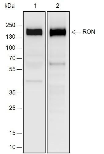 Recombinant RON Monoclonal Antibody (AGEL6927)