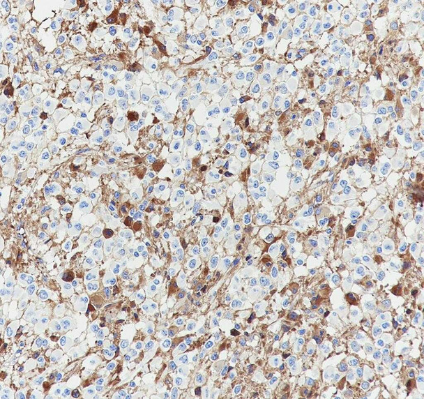 Recombinant EAAT3 Monoclonal Antibody (AGEL6935)