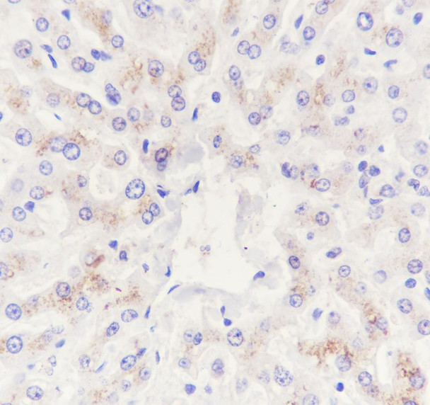 Recombinant C5 Monoclonal Antibody (AGEL6940)