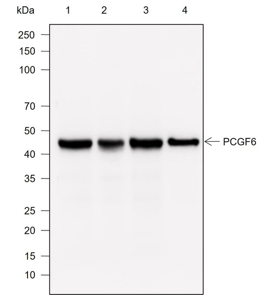 Recombinant PCGF6 Monoclonal Antibody (AGEL6957)