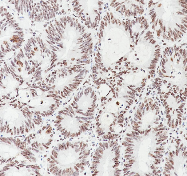 Recombinant MORF4L2 Monoclonal Antibody (AGEL6975)