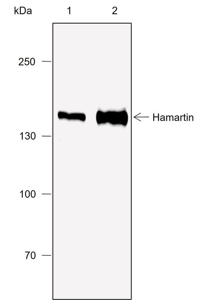 Recombinant Hamartin Monoclonal Antibody (AGEL6979)