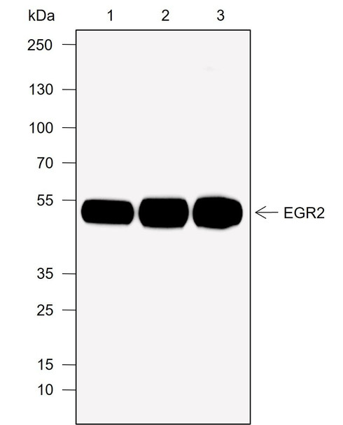 Recombinant EGR2 Monoclonal Antibody (AGEL6982)