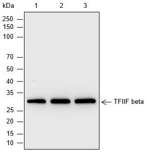 Recombinant TFIIF beta Monoclonal Antibody (AGEL6986)