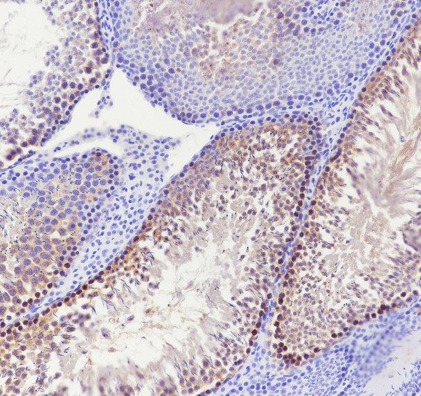 Recombinant CTCFL Monoclonal Antibody (AGEL6987)