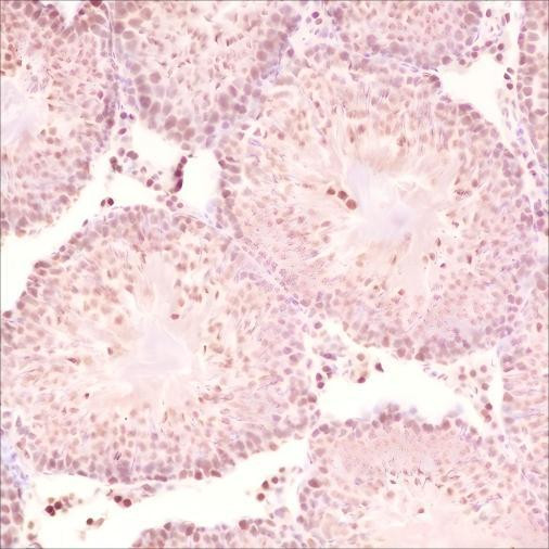 Recombinant SF1 Monoclonal Antibody (AGEL6997)
