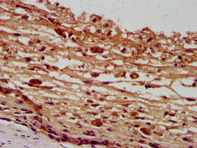 PANX2 Antibody ( PACO66004)