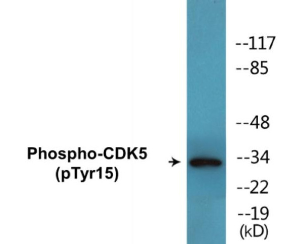 CDK5 Phospho-Tyr15 Colorimetric Cell-Based ELISA Kit