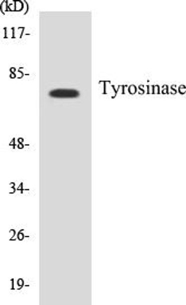 Metabolism Tyrosinase Colorimetric Cell-Based ELISA Kit