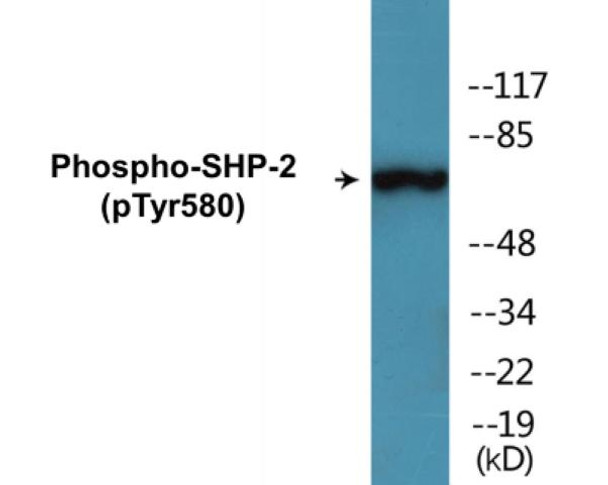 SHP-2 Phospho-Tyr580 Colorimetric Cell-Based ELISA Kit