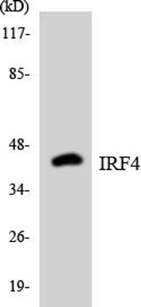 Epigenetics and Nuclear Signaling IRF4 Colorimetric Cell-Based ELISA