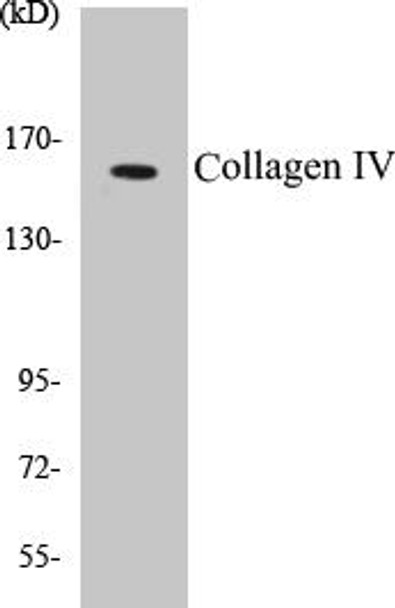 Cardiovascular Collagen IV Colorimetric Cell-Based ELISA Kit