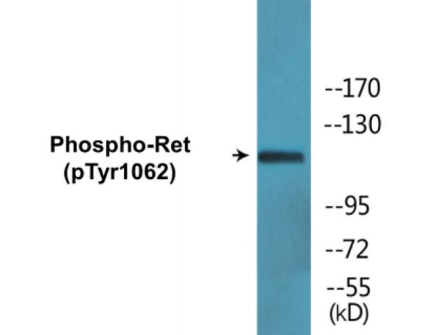 Ret Phospho-Tyr1062 Colorimetric Cell-Based ELISA Kit