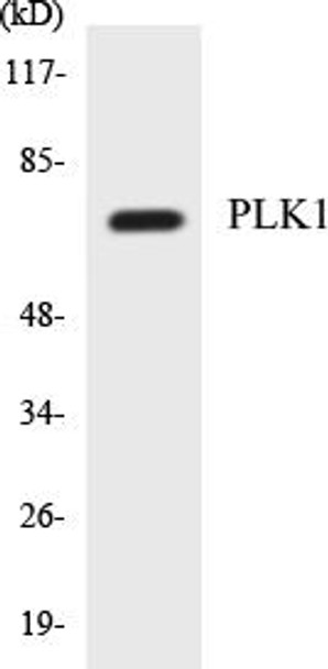 Cell Cycle ELISA Kits PLK1 Colorimetric Cell-Based ELISA Kit