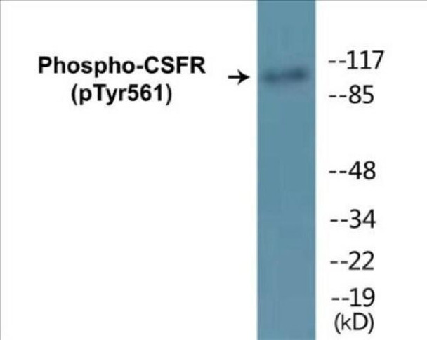 CSFR Phospho-Tyr561 Colorimetric Cell-Based ELISA Kit