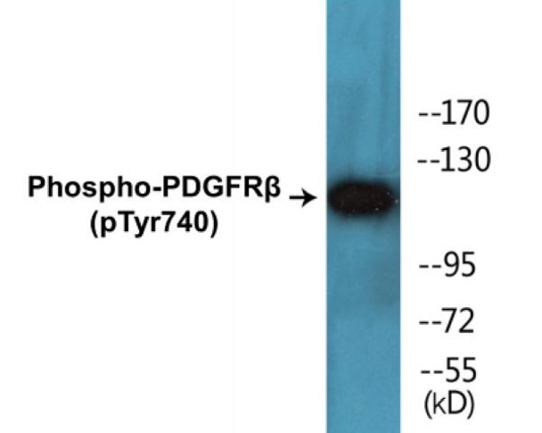 PDGFRbeta Phospho-Tyr740 Colorimetric Cell-Based ELISA Kit