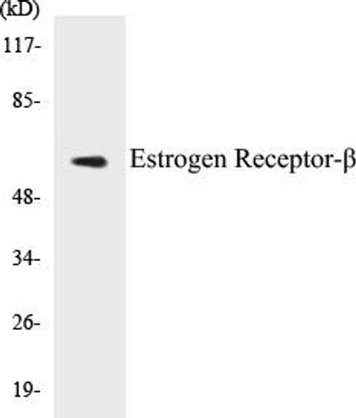 Epigenetics and Nuclear Signaling Estrogen Receptor-beta Colorimetric Cell-Based ELISA Kit