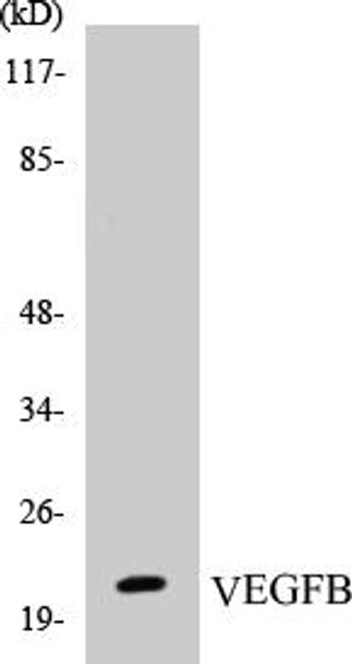 VEGFB Colorimetric Cell-Based ELISA Kit