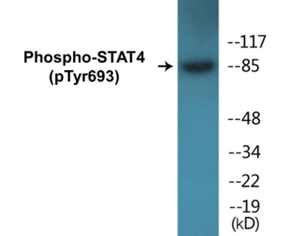 STAT4 Phospho-Tyr693 Colorimetric Cell-Based ELISA Kit