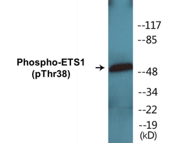 ETS1 Phospho-Thr38 Colorimetric Cell-Based ELISA Kit