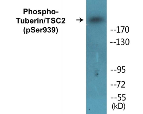 Tuberin/TSC2 Phospho-Ser939 Colorimetric Cell-Based ELISA Kit