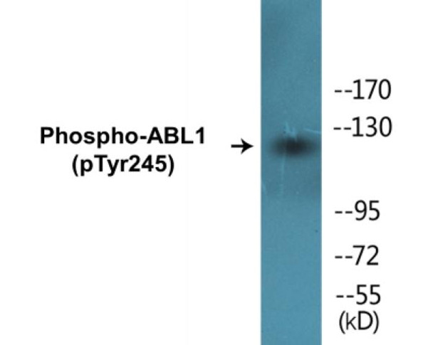 ABL1 Phospho-Tyr245 Colorimetric Cell-Based ELISA Kit