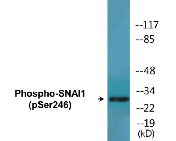 SNAI1 Phospho-Ser246 Colorimetric Cell-Based ELISA Kit
