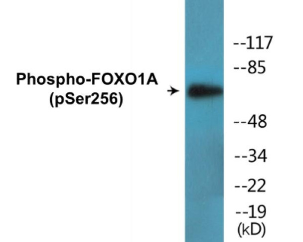 FOXO1A Phospho-Ser256 Colorimetric Cell-Based ELISA Kit