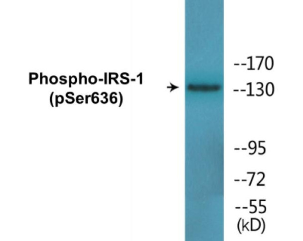 IRS-1 Phospho-Ser636 Colorimetric Cell-Based ELISA Kit