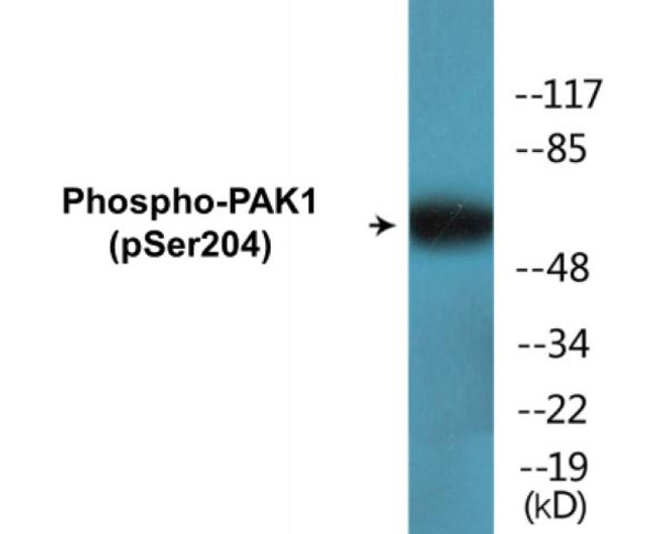 PAK1 Phospho-Ser204 Colorimetric Cell-Based ELISA Kit