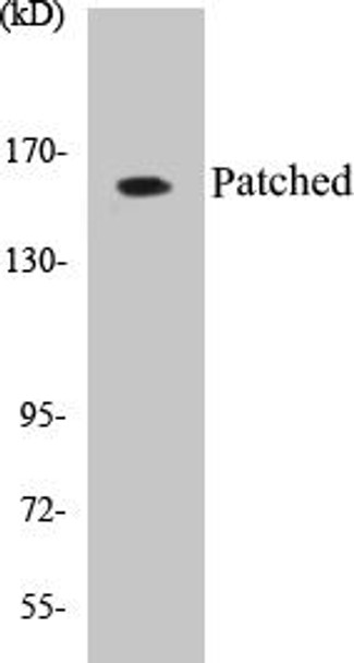 Patched Colorimetric Cell-Based ELISA Kit