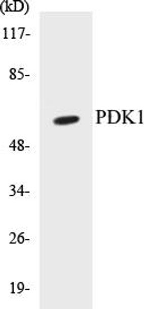 Epigenetics and Nuclear Signaling PDK1 Colorimetric Cell-Based ELISA Kit