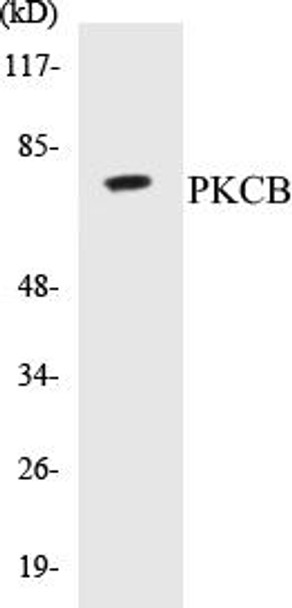 Immunology PKCB Colorimetric Cell-Based ELISA Kit