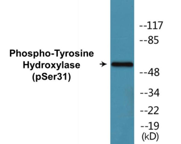 Tyrosine Hydroxylase Phospho-Ser31 Colorimetric Cell-Based ELISA Kit