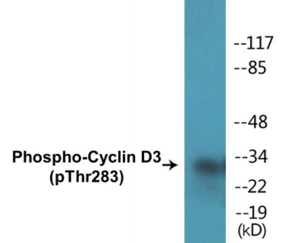 Cyclin D3 Phospho-Thr283 Colorimetric Cell-Based ELISA Kit