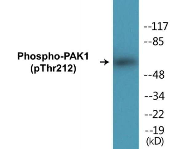 PAK1 Phospho-Thr212 Colorimetric Cell-Based ELISA Kit