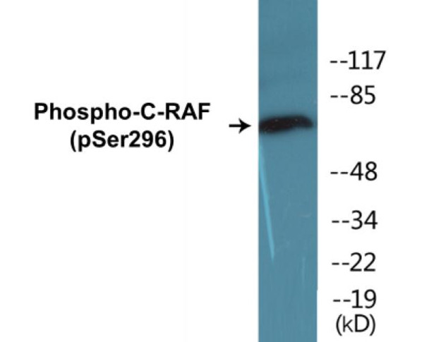 C-RAF Phospho-Ser296 Colorimetric Cell-Based ELISA Kit