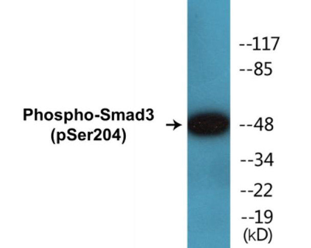 Smad3 Phospho-Ser204 Colorimetric Cell-Based ELISA Kit