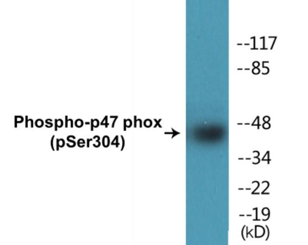 p47 phox Phospho-Ser304 Colorimetric Cell-Based ELISA Kit