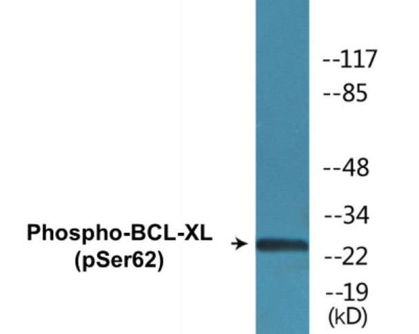 BCL-XL Phospho-Ser62 Colorimetric Cell-Based ELISA Kit