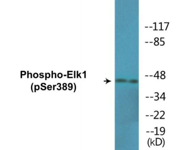 Elk1 Phospho-Ser389 Colorimetric Cell-Based ELISA Kit