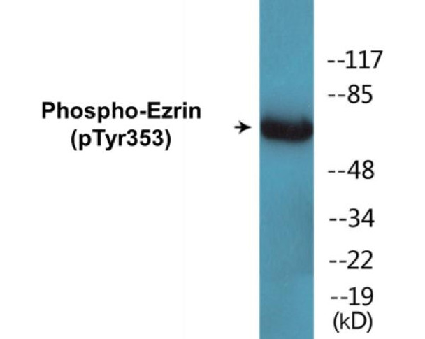 Ezrin Phospho-Tyr353 Colorimetric Cell-Based ELISA Kit