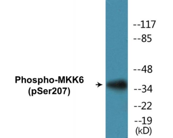 MKK6 Phospho-Ser207 Colorimetric Cell-Based ELISA Kit
