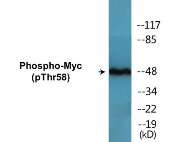 Myc Phospho-Thr58 Colorimetric Cell-Based ELISA Kit