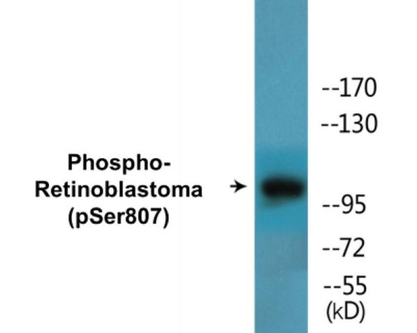 Retinoblastoma Phospho-Ser807 Colorimetric Cell-Based ELISA Kit