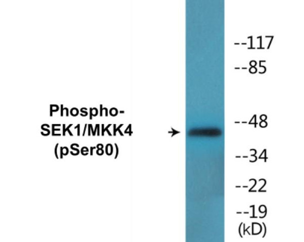 SEK1/MKK4 Phospho-Ser80 Colorimetric Cell-Based ELISA Kit