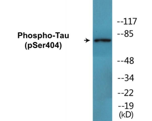Tau Phospho-Ser404 Colorimetric Cell-Based ELISA Kit