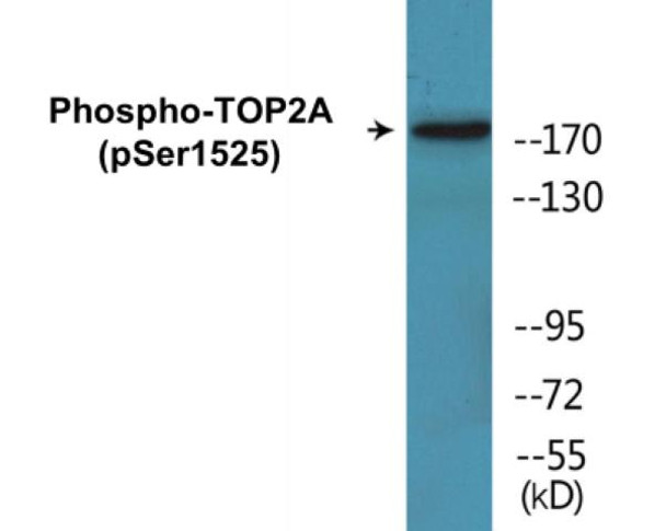 TOP2A Phospho-Ser1525 Colorimetric Cell-Based ELISA Kit